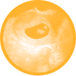 Early Pregnancy Care image