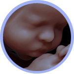 Fetal Medicine image